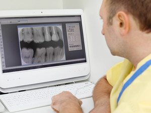 dental xrays everett wa